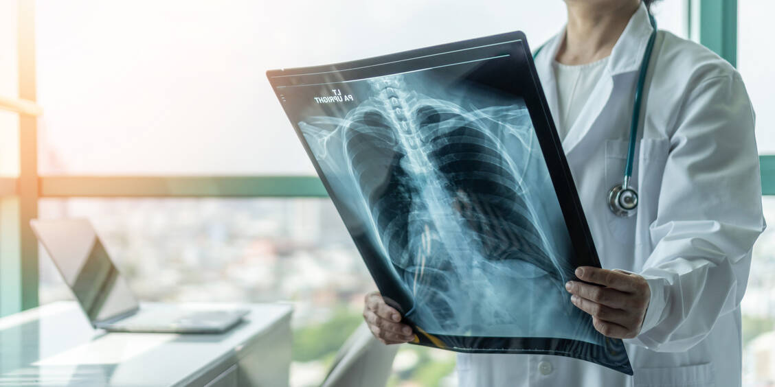 Das SARS-Coronavirus-2 löst offenbar eine Vernarbung der Lunge aus, zeigen zwei aktuelle Studien. / Foto: Adobe Stock/Chinnapong