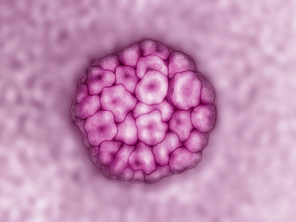 Infektionen mit dem humanen Papillomavirus können Krebs auslösen. Die Tumorzellen haben bestimmte Oberflächenmerkmale, die den Angriffspunkt der therapeutischen Impfung bilden. Foto: Your Photo Today