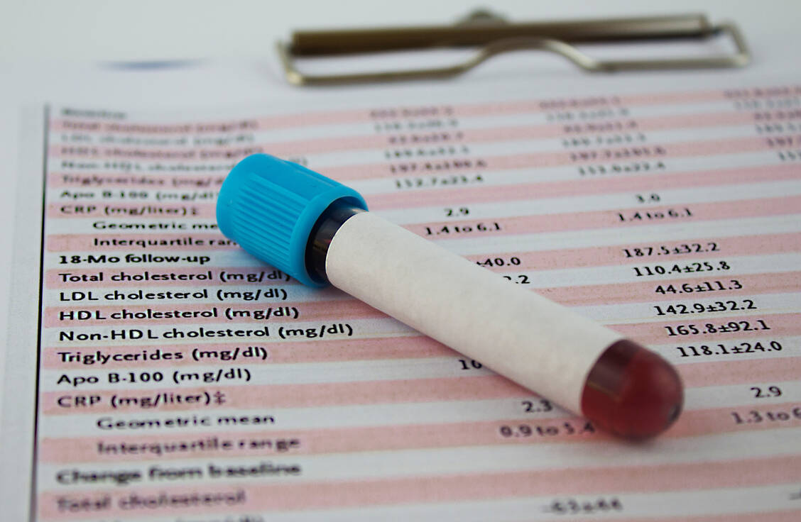 Eine antiretrovirale Therapie bei HIV-Infektion geht häufig mit erhöhten Cholesterolwerten einher. / Foto: Getty Images/blueshot