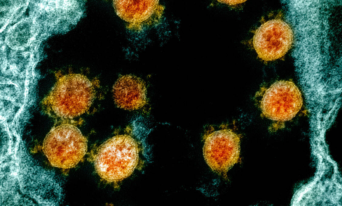 RNA-Viren wie SARS-CoV-2 brauchen RNA-Polymerasen, um sich zu vermehren. Molnupiravir ist wie Remdesivir ein Polymerase-Hemmer. / Foto: NIH-NIAID