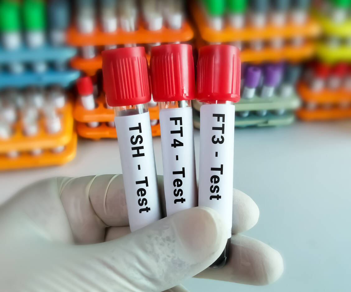 Die Therapie mit Amiodaron muss ärztlich überwacht werden, da der Wirkstoff die Schilddrüsenfunktion stören und – wie alle Antiarrhythmika – selbst Herzrhythmusstörungen verursachen kann. / Foto: Adobe Stock/Saiful52