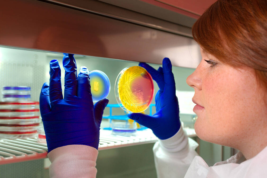 Multiresistente, gramnegative Erreger gewinnen zunehmend an Bedeutung. Besonders problematisch sind Carbapenemase-bildende Enterobakterien, die inzwischen gegenüber zahlreichen Antibiotika resistent sind. Neue Therapieoptionen werden daher benötigt. / Foto: CDC/Melissa Dankel/James Gathany