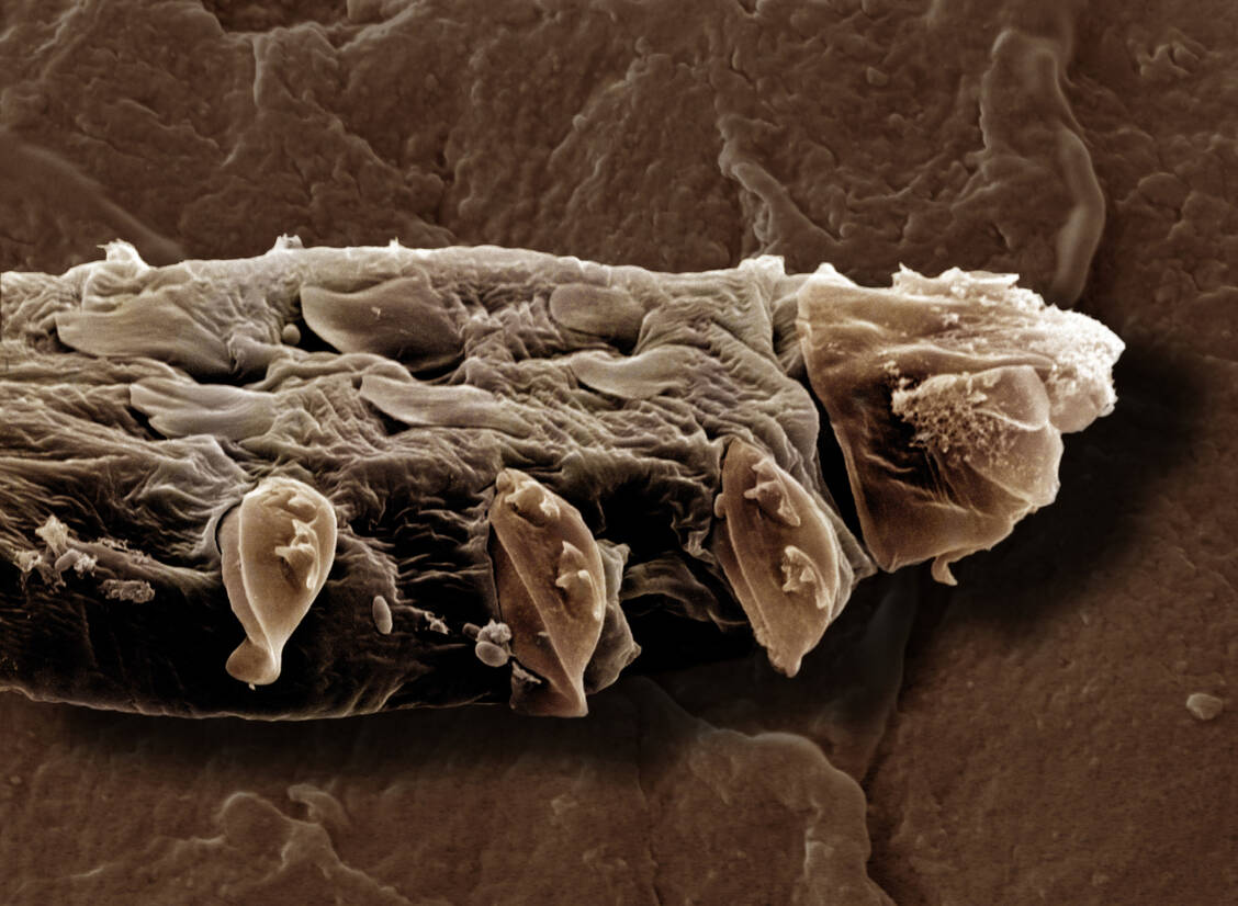Zwei Arten von Haarbalgmilben kommen beim Menschen vor: Demodex brevis und Demodex folliculorum .  / © Getty Images/David Spears FRPS FRMS