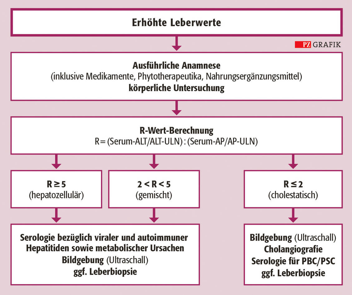 Schematischer Algorithmus zur Abklärung erhöhter Leberwerte / Foto: Stephan Spitzer