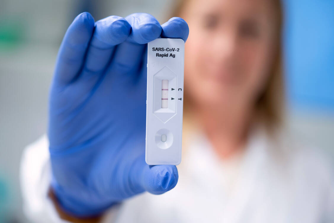 Schnelltests sind bislang nur einem begrenzten Kreis zugänglich. Das könnte sich bald ändern.  / Foto: picture alliance / TT NYHETSBYR?N | Johan Nilsson/TT