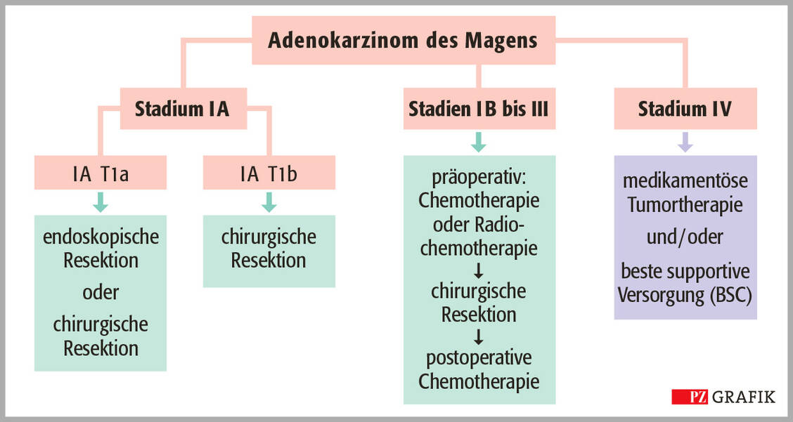 Grafik 2: Algorithmus zur Primärtherapie eines Magenkarzinoms; modifiziert nach Onkopedia-Leitlinie (11) / Foto: PZ/Stephan Spitzer