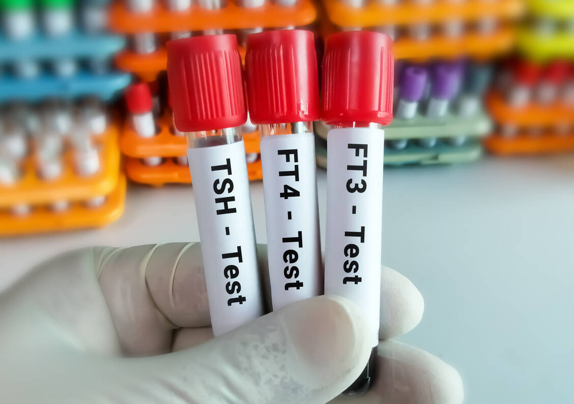 Das Thyreoidea-stimulierende Hormon (TSH) regt die Schilddrüse zur Bildung von Triiodthyronin (T3) und Thyroxin (T4) an und ist der erste Laborparameter, der bei Verdacht auf eine Schilddrüsenfunktionsstörung untersucht wird. / Foto: Getty Images/Md Saiful Islam Khan