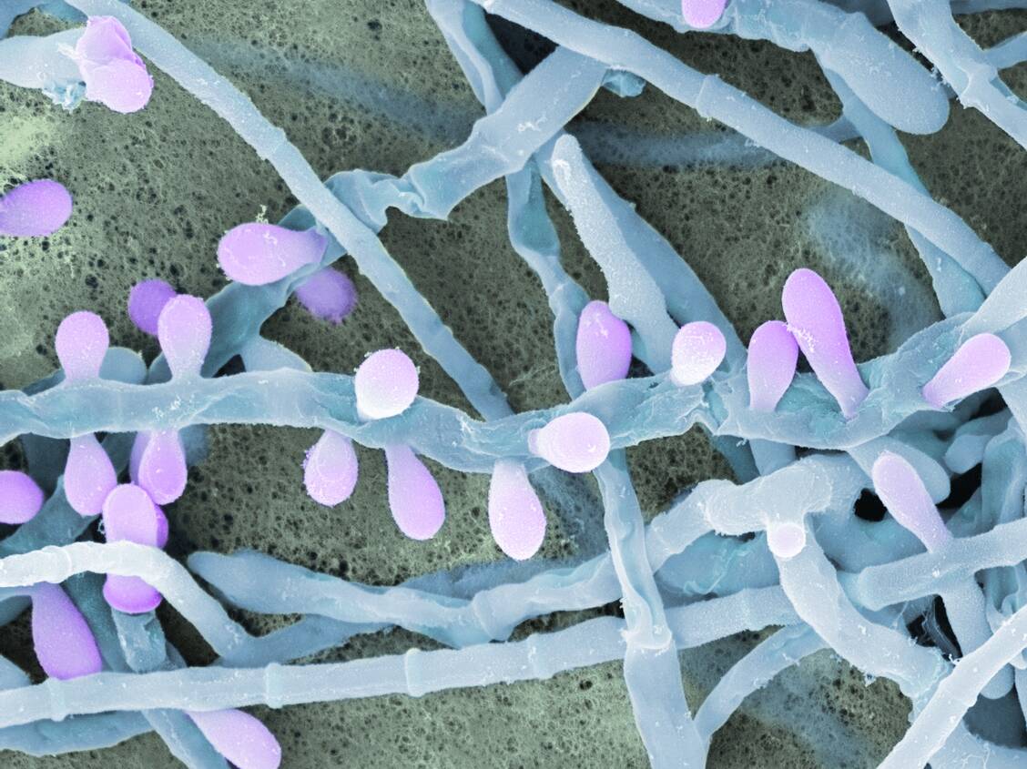 Ein Blick durchs Elektronenmikroskop zeigt den Hauptauslöser von Nagelpilz: Trichophyton rubrum. Gut zu erkennen sind die fadenförmigen Hyphen und die bläschenartigen Sporen. / Foto: Science Photo Library / Lounatmaa, Dr. Kari