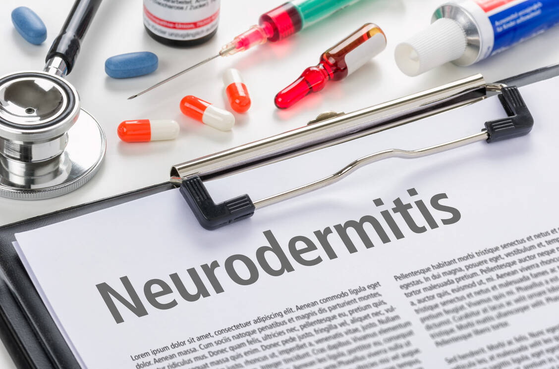 In den USA gibt es eine weitere lokale Therapieoption bei Neurodermitis. Der Januskinase-Hemmer Ruxolitinib hat die Zulassung der FDA erhalten. / Foto: Adobe Stock/Zerbor