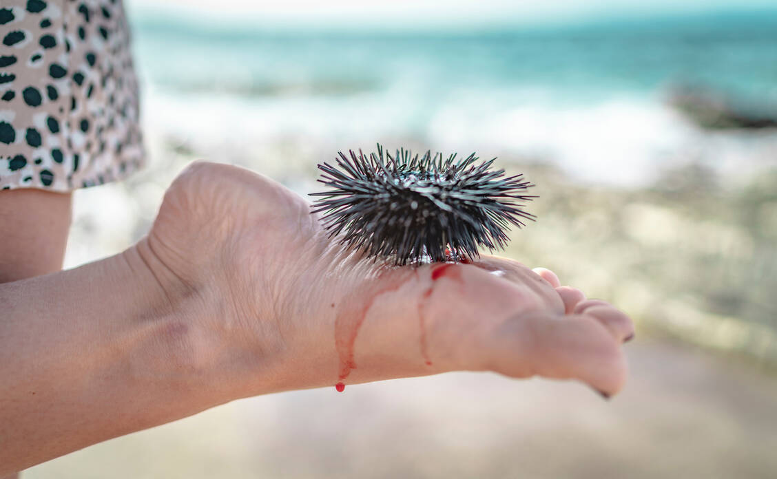 Das tut richtig weh! / Foto: Adobe Stock/Anselm