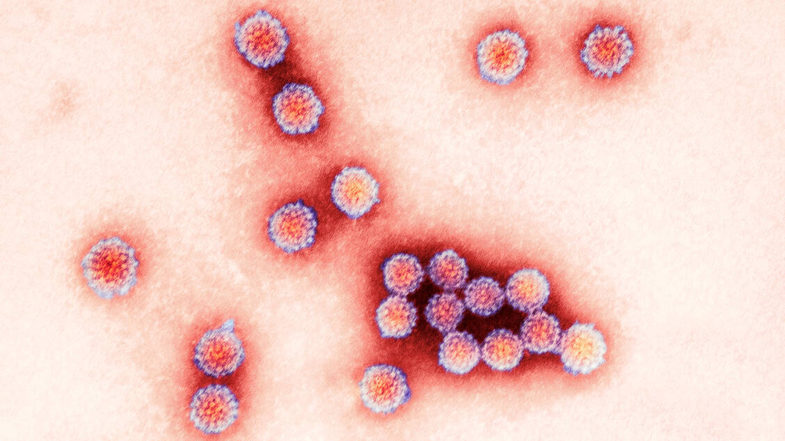 Infektionen mit humanen Papillomviren können verschiedene Krebsarten verursachen. Die Impfung gegen HPV ist daher die erste Schutzimpfung gegen Krebs. / Foto: Science Photo Library/ Public Health England/Centre for Infections