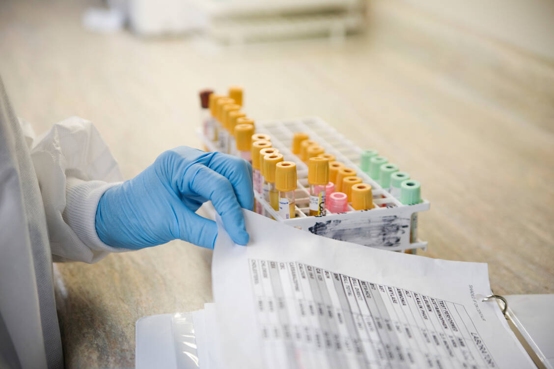 Störungen der Elektrolyte im Blut sind immer im Kontext mit anderen Symptomen oder Auffälligkeiten zu sehen. Die Ursachensuche kann komplex sein. / Foto: Getty Images/Dana Neely