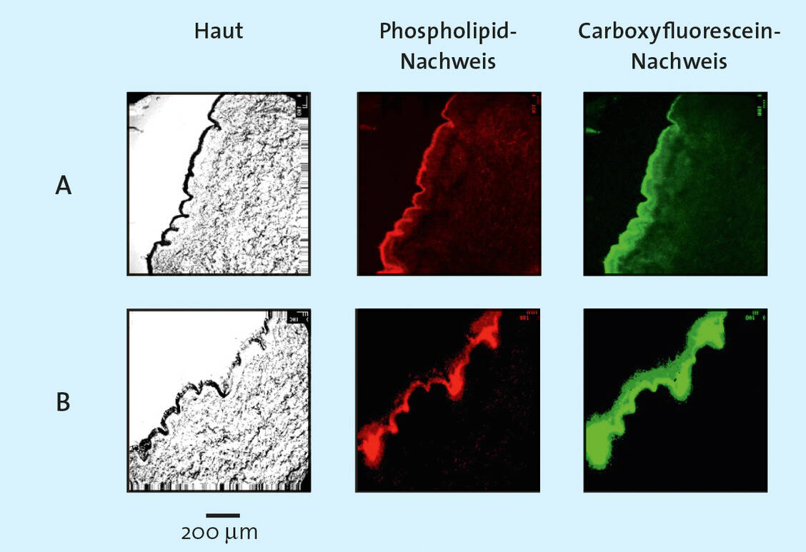 Abbildung 4: Vergleich des Hautverteilungsmusters von Liposomen, die den wasserlöslichen Marker Carboxyfluorescein (CF-Nachweis) und den lipophilen Marker N-Rhodamin-PE (Lipidnachweis) enthalten. (A) ungesättigtes Phospholipid oder (B) gesättigtes Phospholipid, Balken 200 µm. / Foto: mit Erlaubnis des Herausgebers aus: Fahr et al., SÖFW-Journal 126, 48, 2000