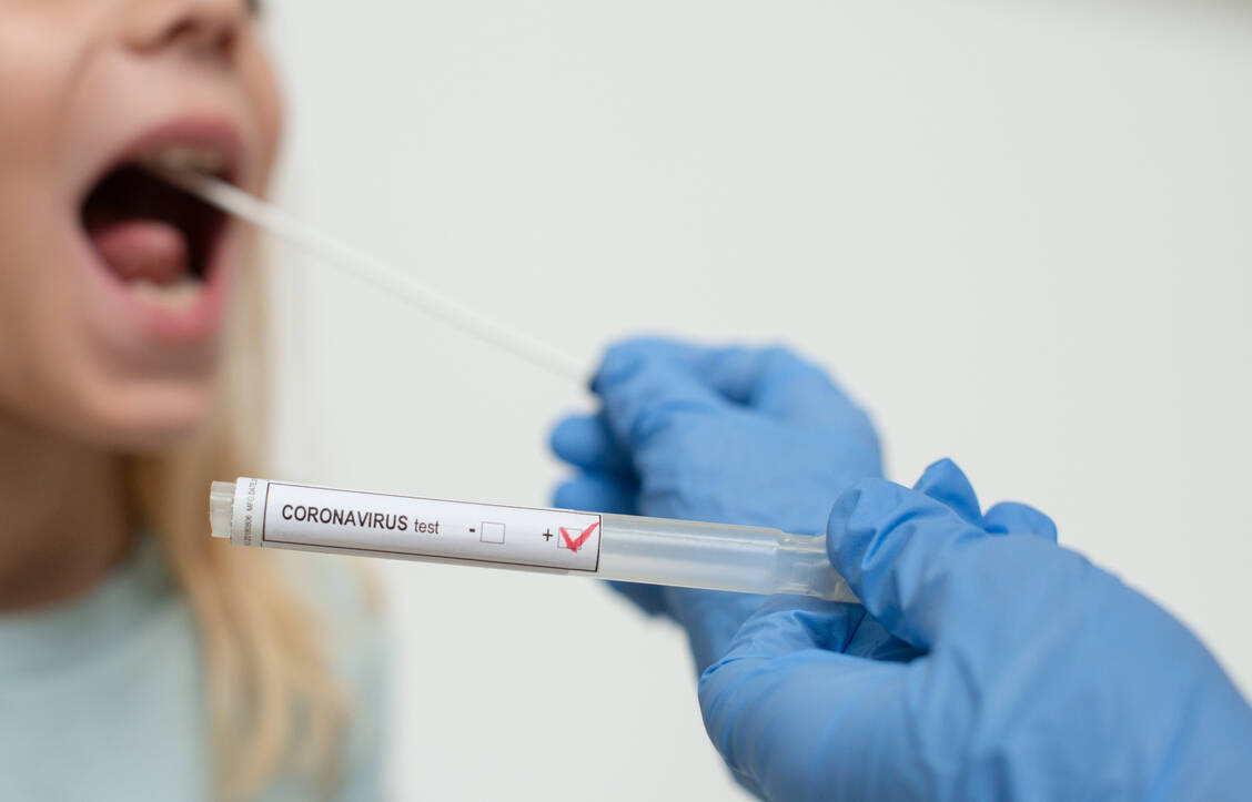 In der Gemeinde Kupferzell haben sich zwischen dem 20. Mai bis 9. Juni 2203 Erwachsene auf das Coronavirus testen lassen (Symbolbild). / Foto: Getty Images/BPS