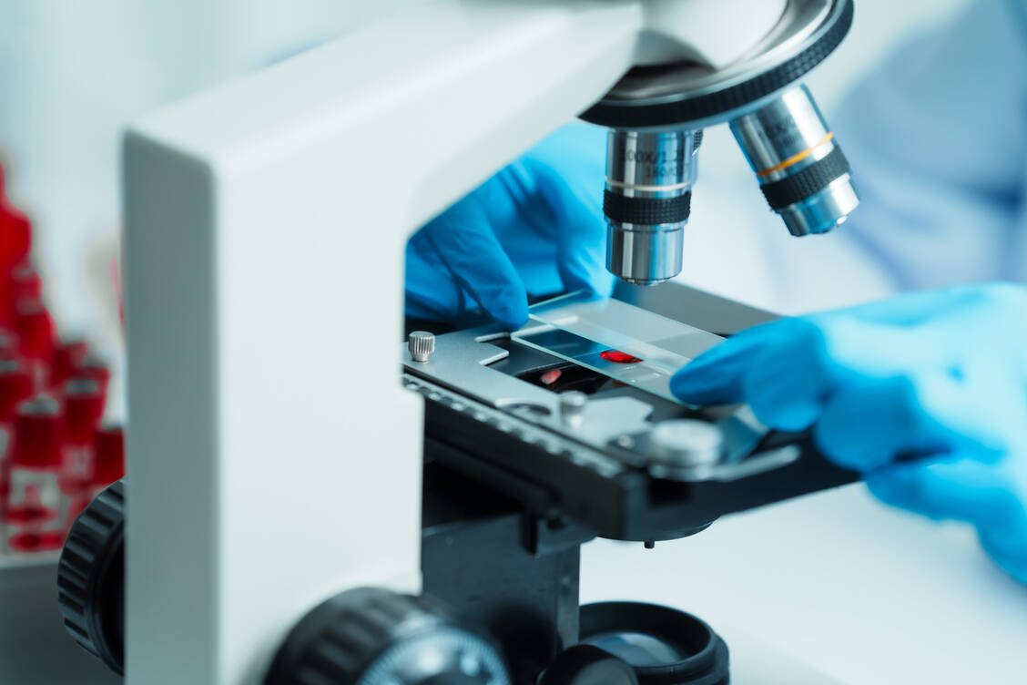 Schwedischen Forschern  fielen sieben Laborwerte auf, die signifikant mit Multimorbidität verbunden waren. / © Adobe Stock/R Photography