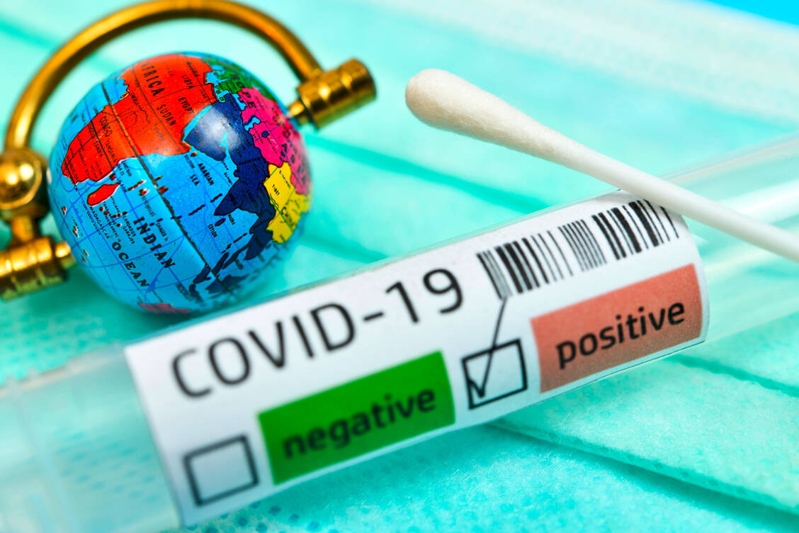 Die Coronavirus-Pandemie stellt das Gesundheitswesen global vor die riesige Herausforderung, die oft schwer Erkrankten adäquat zu versorgen. / Foto: Imago Images/Christian Ohde