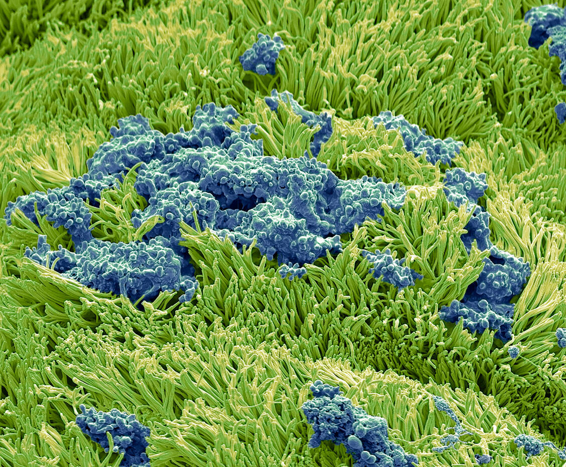 Die Flimmerhärchen (grün) haben bei einem Infekt ordentlich Arbeit, das Bronchialsekret (blau) gut fließend zu halten. / Foto: Science Photo Library/Gschmeissner, Steve
