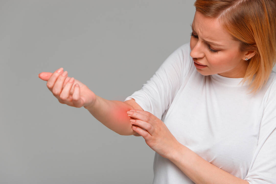 Eine atopische Dermatitis wird oft von quälendem Juckreiz begleitet. Schwindet die Entzündung unter Biologika wie Tralokinumab, lässt oft auch der Juckreiz nach.  / Foto: Adobe Stock/DimaBerlin