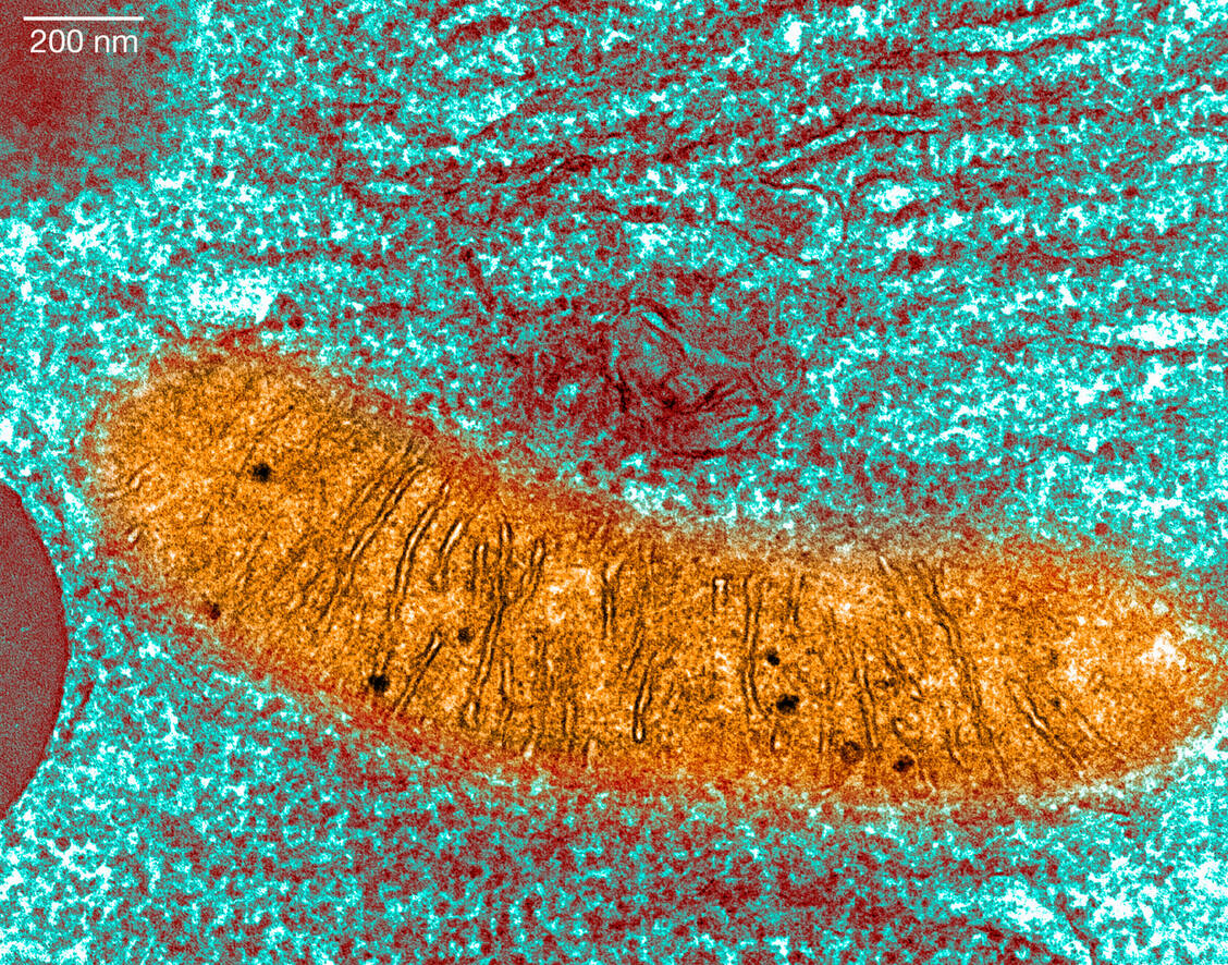 Die Mitochondrien, die Kraftwerke der Zelle, sind bei Patienten mit Thymidinkinase-2-Mangel in ihrer Funktion gestört. Betroffene Patienten leiden in der Folge an einer zunehmenden Muskelschwäche. / © Getty Images/Callista Images