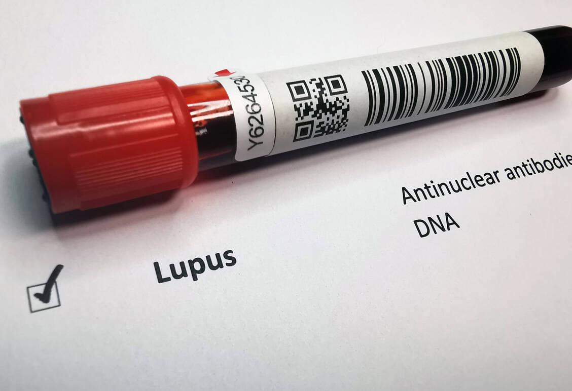 Beim systemischen Lupus erythematodes bildet das Immunsystem fälschlicherweise Autoantikörper gegen körpereigene Zellbestandteile, die sich in verschiedenen Organen ablagern und dort schwere Entzündungen auslösen können. / © Getty Images/Hailshadow