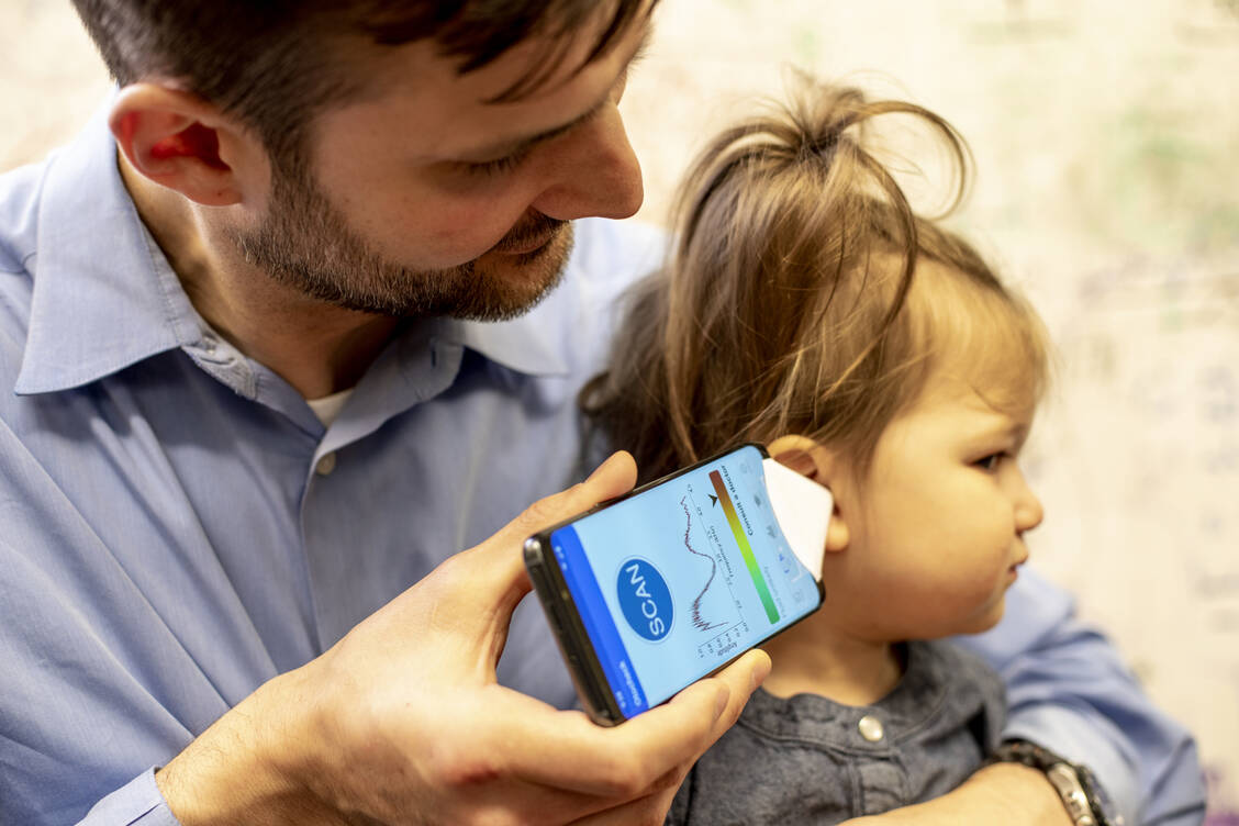 Ein Smartphone und ein Blatt Papier, aus dem man einen Trichter bastelt: Mehr braucht man nicht, um mittels der neuen App eine Flüssigkeitsansammlung im Mittelohr zu entdecken. / Foto: University of Washington/Dennis Wise