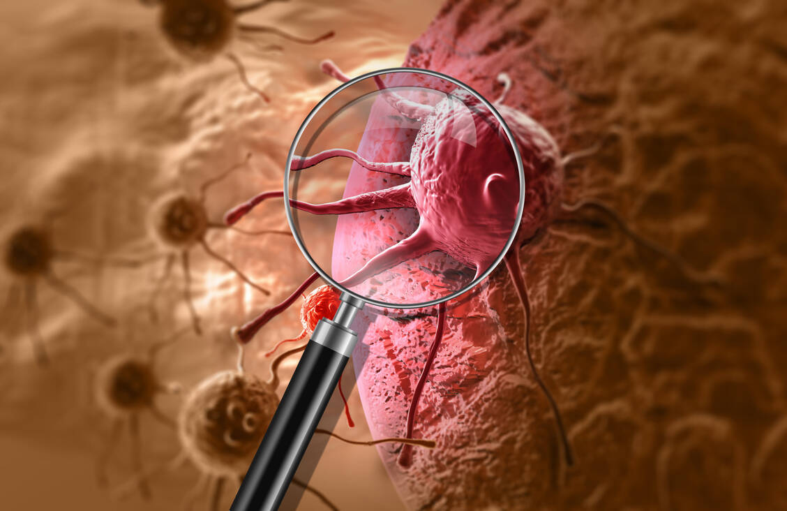 Derzeit gibt es keine zugelassenen zielgerichteten Therapieoptionen für Patienten mit KRAS<sup>G12C</sup>-Mutationen. Forscher arbeiten jedoch daran, dies zu ändern. / Foto: Adobe Stock/vitanovski