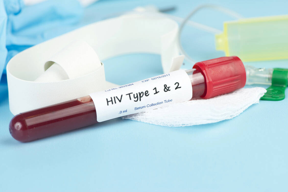 Beim Londoner Patienten finden sich seit Jahren keine vermehrungsfähige Viren mehr in Proben. / Foto: Fotolia/Sherry Yates Young