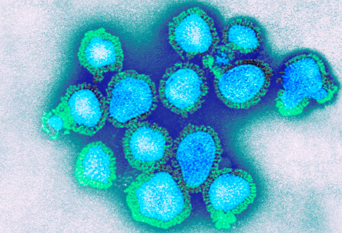 Influenzaviren unter dem Rasterelektronenmikroskop / Foto: Getty Images/CDC/Science Photo Library