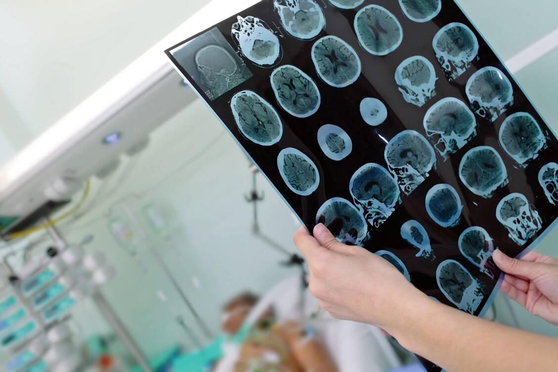 Covid-19-Patienten sollten regelmäßig auf neurologische Begleiterkrankungen gescreent werden, empfiehlt die DGN. / Foto: Fotolia/sudok1