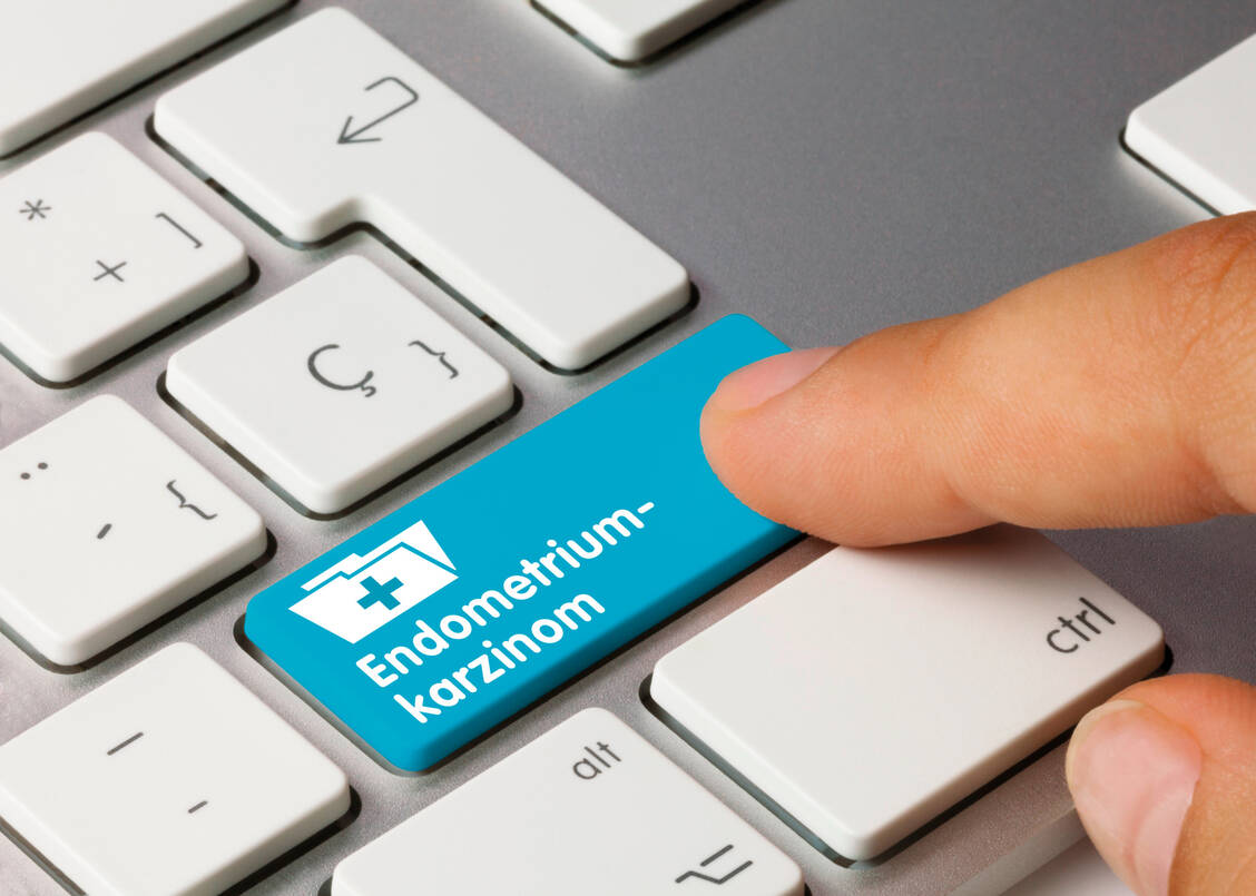 Beim Endometriumkarzinom entarten Schleimhautzellen des Gebärmutterkörpers. / Foto: Adobe Stock/momius