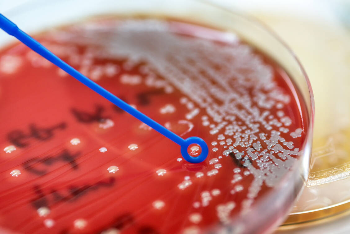 Multiresistente Erreger könnten die Medizin um viele Jahre zurückwerfen.  / Foto: Adobe Stock/analysis121980