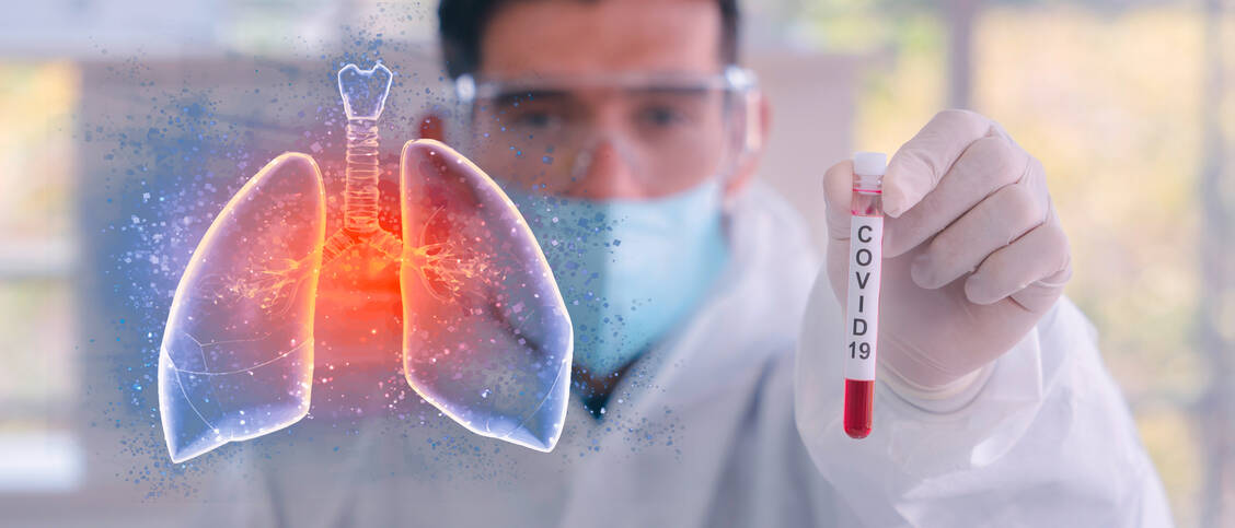 Schwere Lungenentzündungen und Vernarbungen des Lungengewebes  sind eine der möglichen Folge von Covid-19. Sie können die Lungenfunktion langfristig einschränken. Ein Spray soll Abhilfe schaffen. / Foto: Shutterstock/ Mongkolchon Akesin