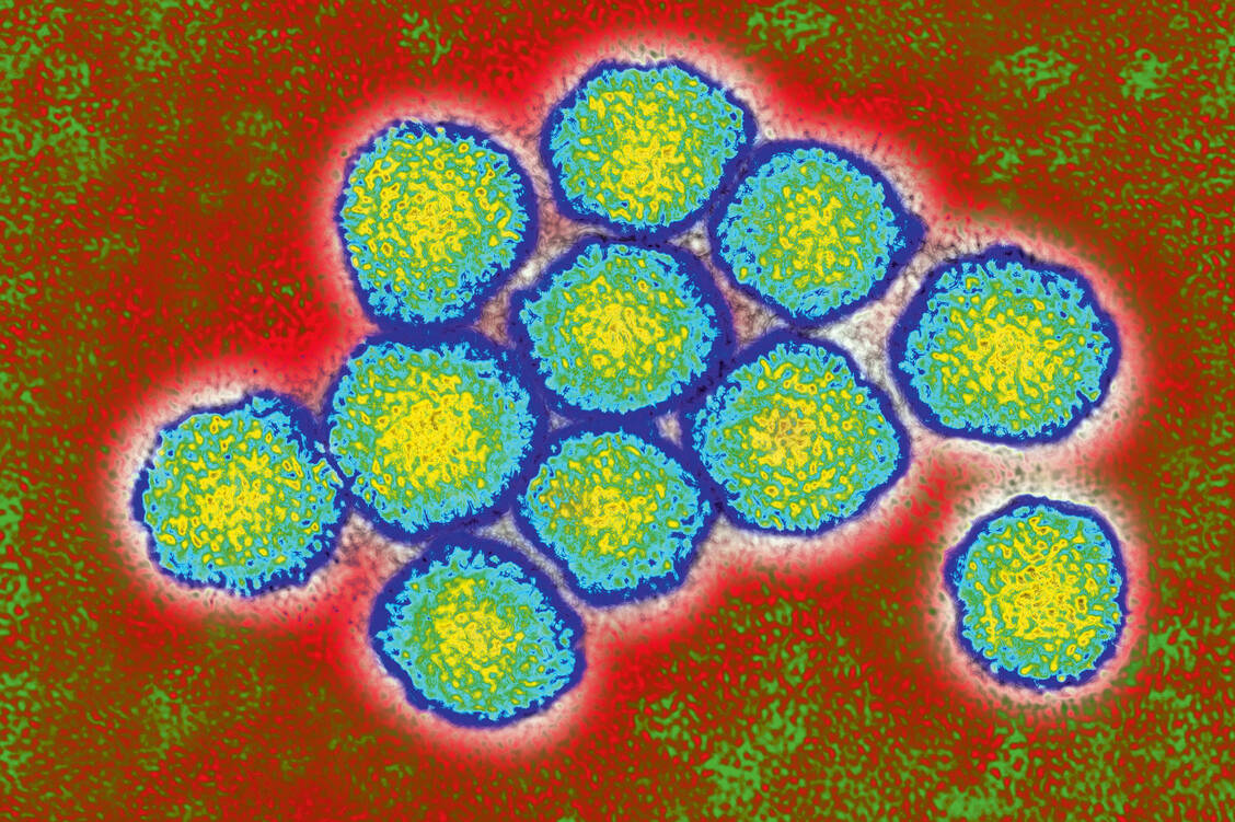 Neuesten Zahlen zufolge wurde in den vergangenen Jahren in Deutschland bei mehr Personen eine Infektion mit dem Hepatitis-C-Virus festgestellt. / Foto: OKAPIA/BSIP/James Cavallini