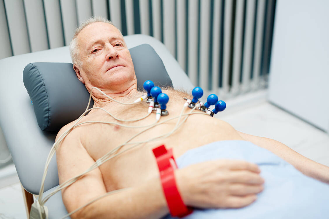 Vorhofflimmern, ein wichtiger Risikofaktor für Schlaganfälle, kann mittels EKG erkannt werden. / Foto: Adobe Stock/pressmaster