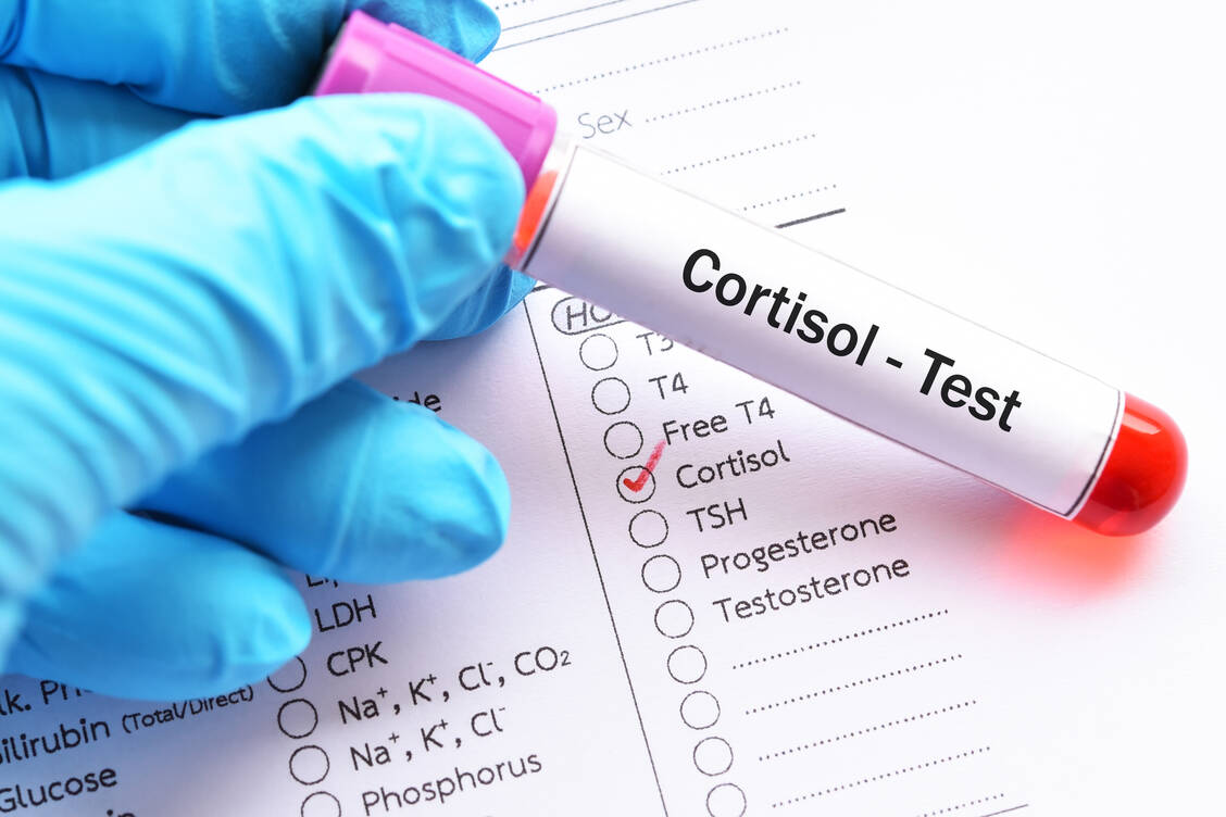 Das Cushing-Syndrom ist durch eine krankhaft gesteigerte Produktion von Cortisol gekennzeichnet.  / Foto: Adobe Stock/jarun011