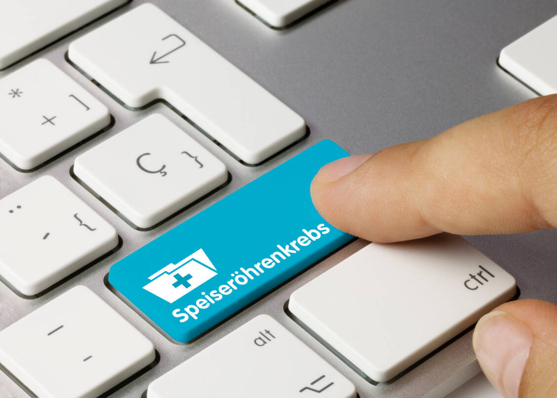 Speiseröhrenkrebs ist in Deutschland eine Tumorerkrankung, die an Häufigkeit zunimmt. / Foto: Adobe Stock/momius
