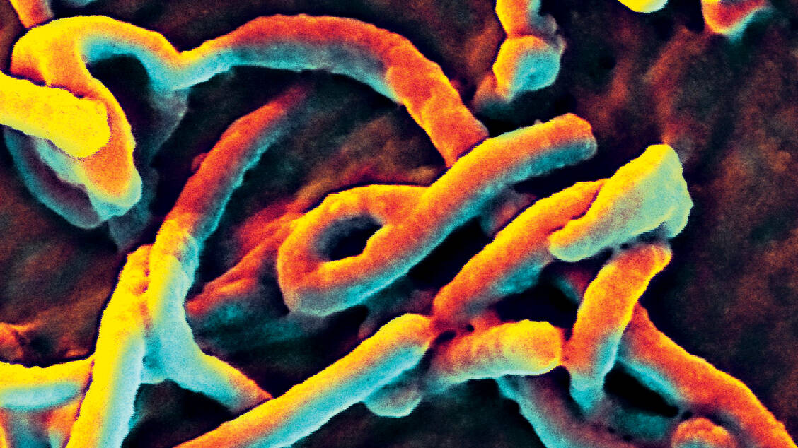 Mehr als 650 Menschen rund um die Großstadt Beni im Ost-Kongo haben sich bereits mit dem Ebola-Virus angesteckt. Foto: CDC/NIAID
