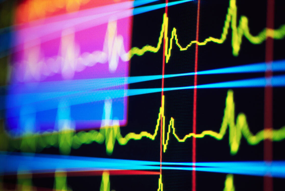 Bestimmte Biomarker können auf ein erhöhtes Risiko für Herzinfarkte und andere schwerwiegende Herz-Kreislauf-Ereignisse hindeuten. Die Zusammenhänge sind jedoch komplex. / © Getty Images/Randy Faris