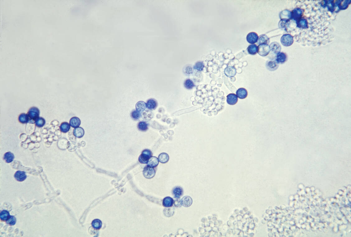 Hefepilze der Gattung Candida besiedeln häufig Haut und Schleimhäute. Ist das Immunsystem geschwächt, können sie überhandnehmen. / Foto: CDC/Dr. Godon Roberstad