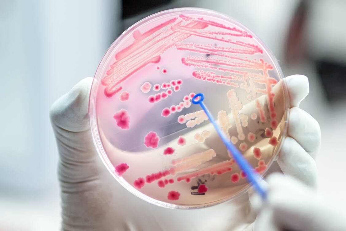 Hochrechnungen des Europäischen Zentrums für die Prävention und Kontrolle von Krankheiten (ECDC) zufolge erkranken in Europa jedes Jahr circa 670.000 Menschen an Infektionen durch multiresistente Erreger. / Foto: Adobe Stock/analysis121980