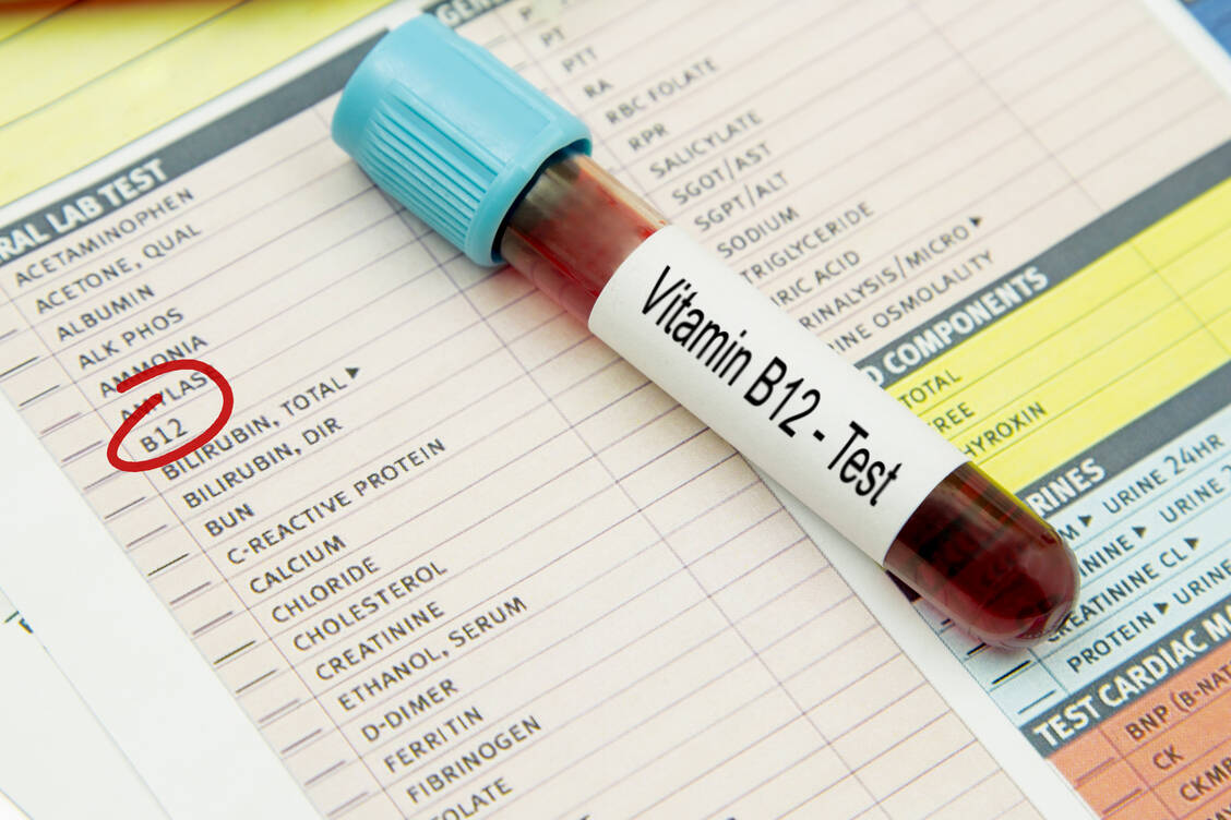 Zu niedrige Blutwerte von Vitamin B<sub>12</sub> können zu Blutarmut und Nervenschäden führen. / Foto: Getty Images/blueshot