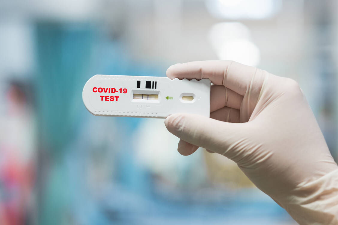 Im baden-württembergischen Böblingen kann sich jeder Bürger zwei Mal in der Woche kostenlos auf eine Infektion mit dem Coronavirus testen lassen. Die Kosten trägt der Landkreis. / Foto: Getty Images/Jackyenjoyphotography