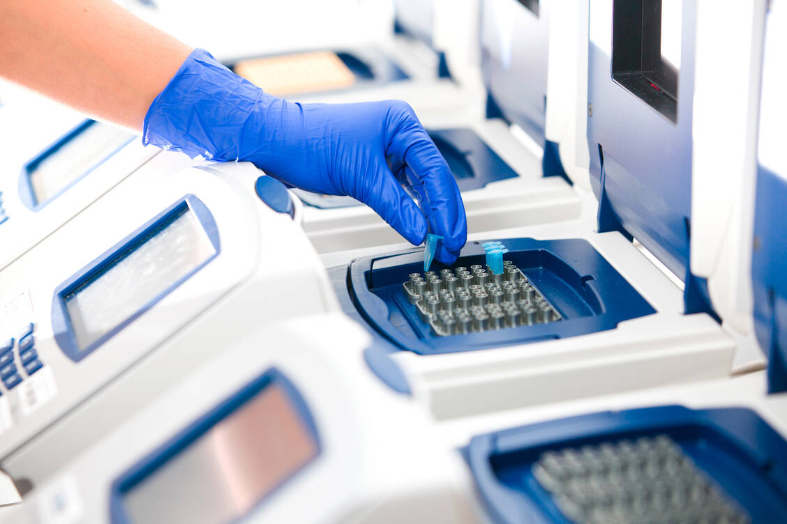 Derzeit werden in Deutschland pro Woche 350.000 Menschen auf SARS-CoV-2 getestet. Dass bereits seit Beginn der Epidemie breit getestet wird und deshalb auch leichte Fälle erfasst werden, sehen Experten als Grund für die momentan noch vergleichsweise niedrige Sterberate. / Foto: Adobe Stock/Vit Kovalcik