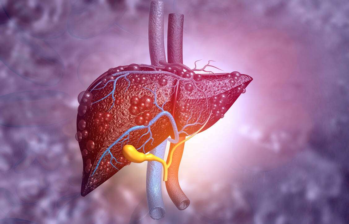 Starkes Übergewicht und Fettleibigkeit sind zwei der wichtigsten Risikofaktoren für eine metabolische Fettleber. / © Adobe Stock/Rasi