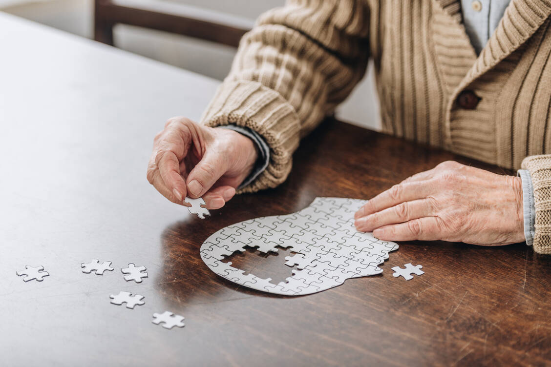 Im Gehirn von Alzheimer-Patienten sind Amyloid-Plaques nachzuweisen. Zum Krankheitsbild gehören zum Beispiel Gedächtnis- und Orientierungsstörungen sowie Sprachstörungen, / Foto: Adobe Stock/Lightfield Studios