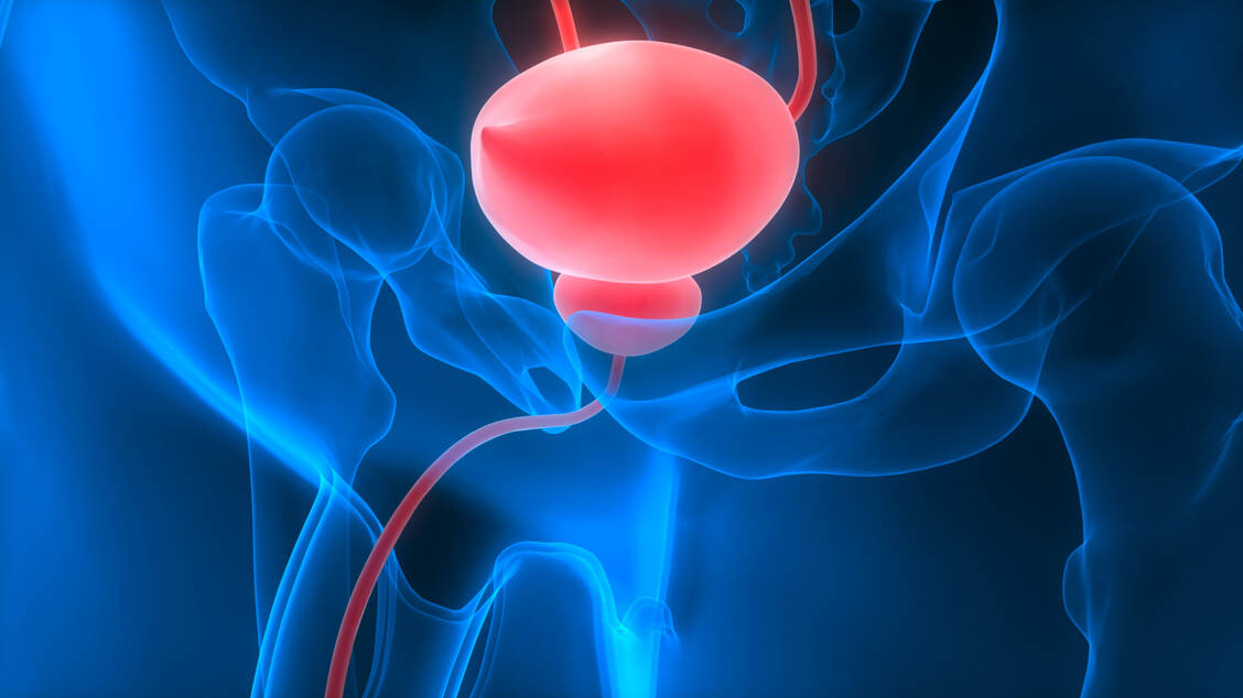 In Europa wurde im Jahr 2020 bei etwa 200.000 Menschen Urothelkrebs diagnostiziert. / Foto: Adobe Stock/magicmine