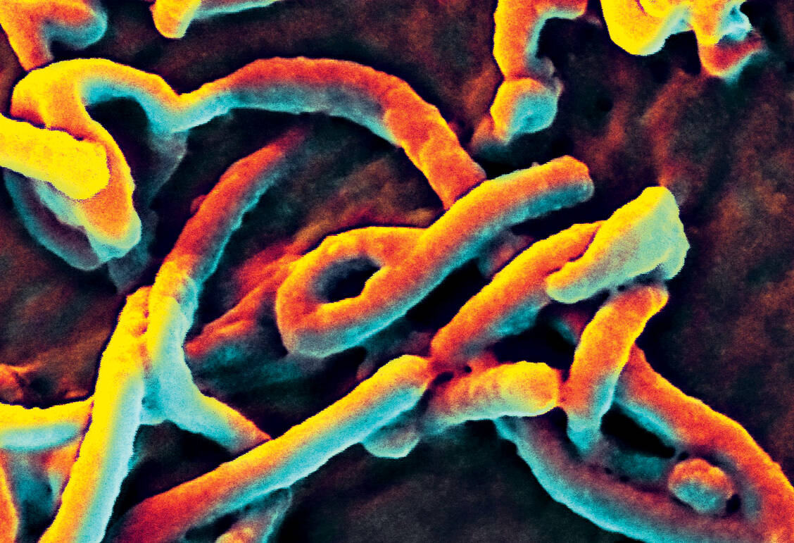 Infektionen mit dem zu den Filoviridae gehörenden Ebolavirus verlaufen in 25 bis 90 Prozent der Fälle tödliche. Beim derzeitigen Ausbruch im Kongo beträgt die Sterblichkeit 67 Prozent. / Foto: CDC/NIAID