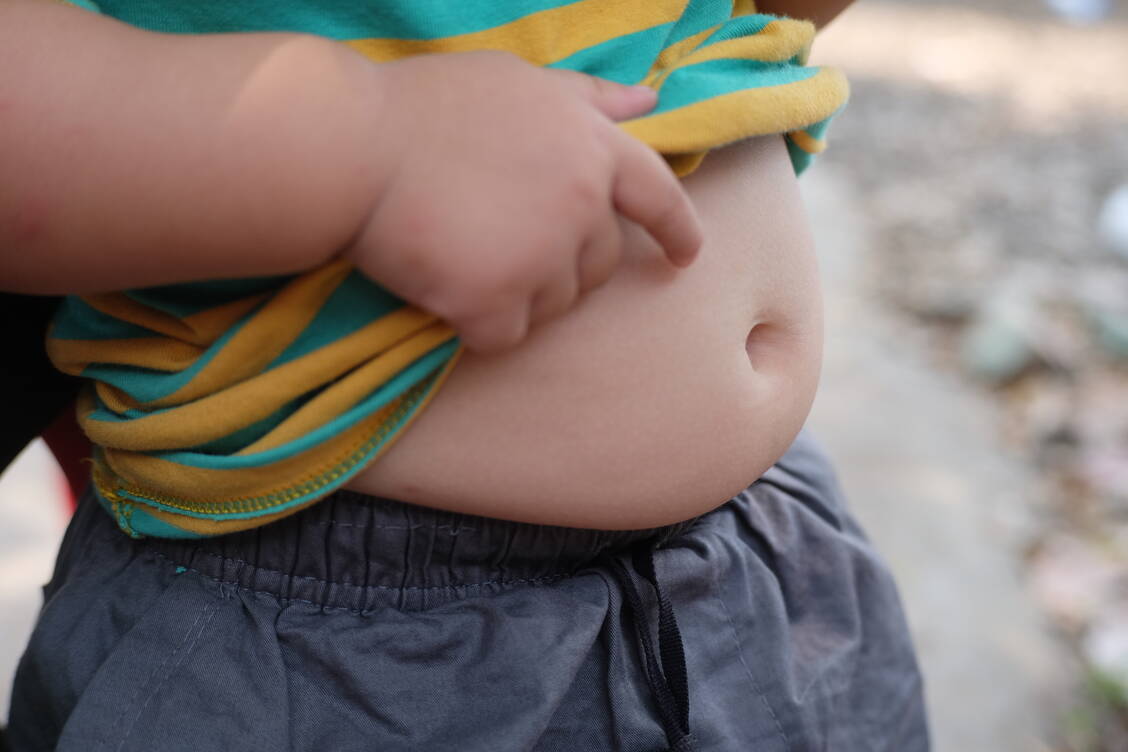 Babyspeck wächst sich nicht immer aus. Eltern sind mit Gewichtsproblemen ihres Nachwuchses zu nachsichtig, zeigt eine aktuelle Studie. / Foto: Shutterstock/Leeferiin