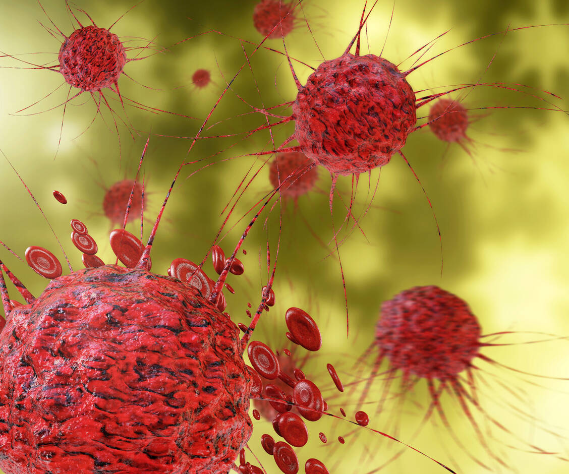 Jeder Tumor ist anders: Die neuen mRNA-Krebsimpfstoffe werden auf das Mutationsmuster eines Tumors abgestimmt. / Foto: Adobe Stock/fotoliaxrender