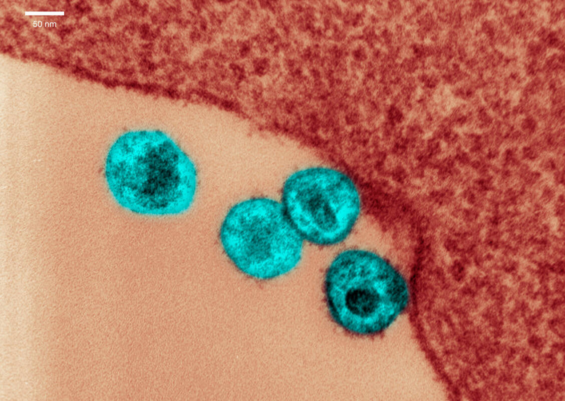 In bestimmten Zellen kann sich das HI-Virus verstecken und ein sogenanntes Reservoir bilden, das für die antiretrovirale Therapie nicht erreichbar ist. Forschende haben diese Zellen nun charakterisiert. / © Getty Images/Callista Images